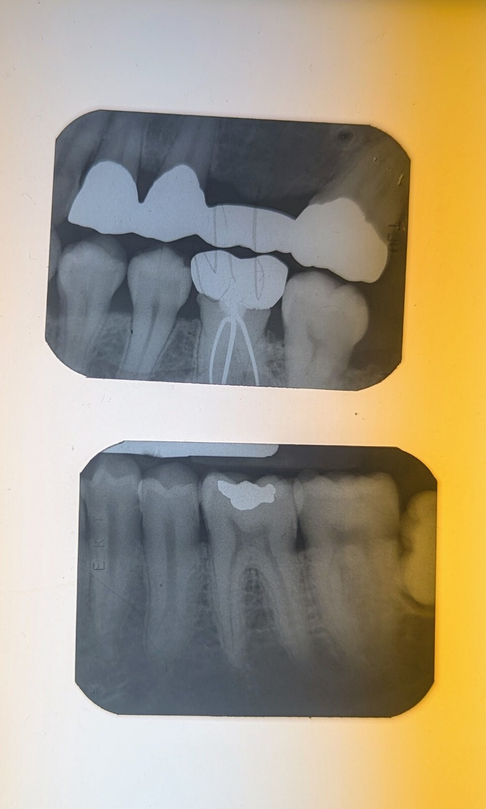 10 Dental X-ray Films, Vintage Curiosities & Oddities 