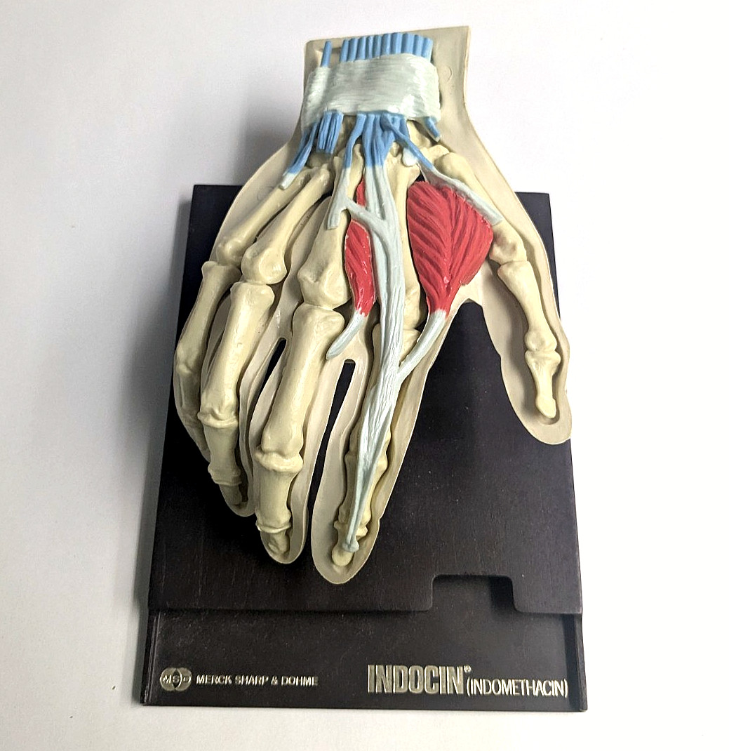 Vintage 1960s Merck Indocin Anatomical Hand Model Medical Advertising Display Vintage 1960s Merck Indocin Anatomical Hand Model Medical Advertising Display