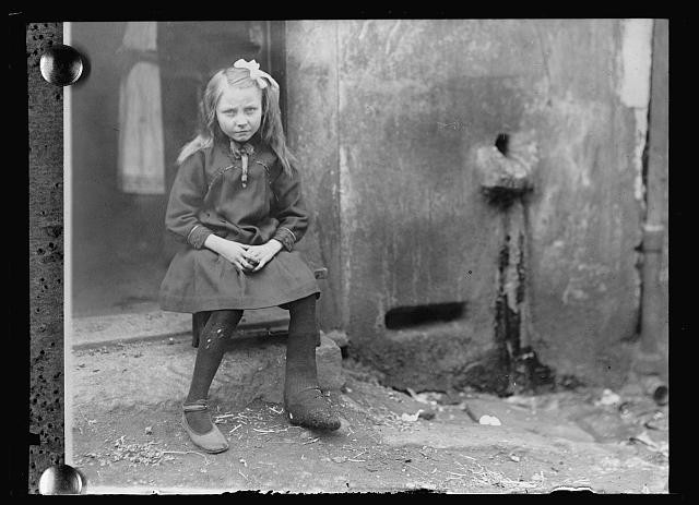 Villars France 1918 Child Tuberculosis Leg American Red Cross St Etienne Villars France 1918 Child Tuberculosis Leg American Red Cross St Etienne