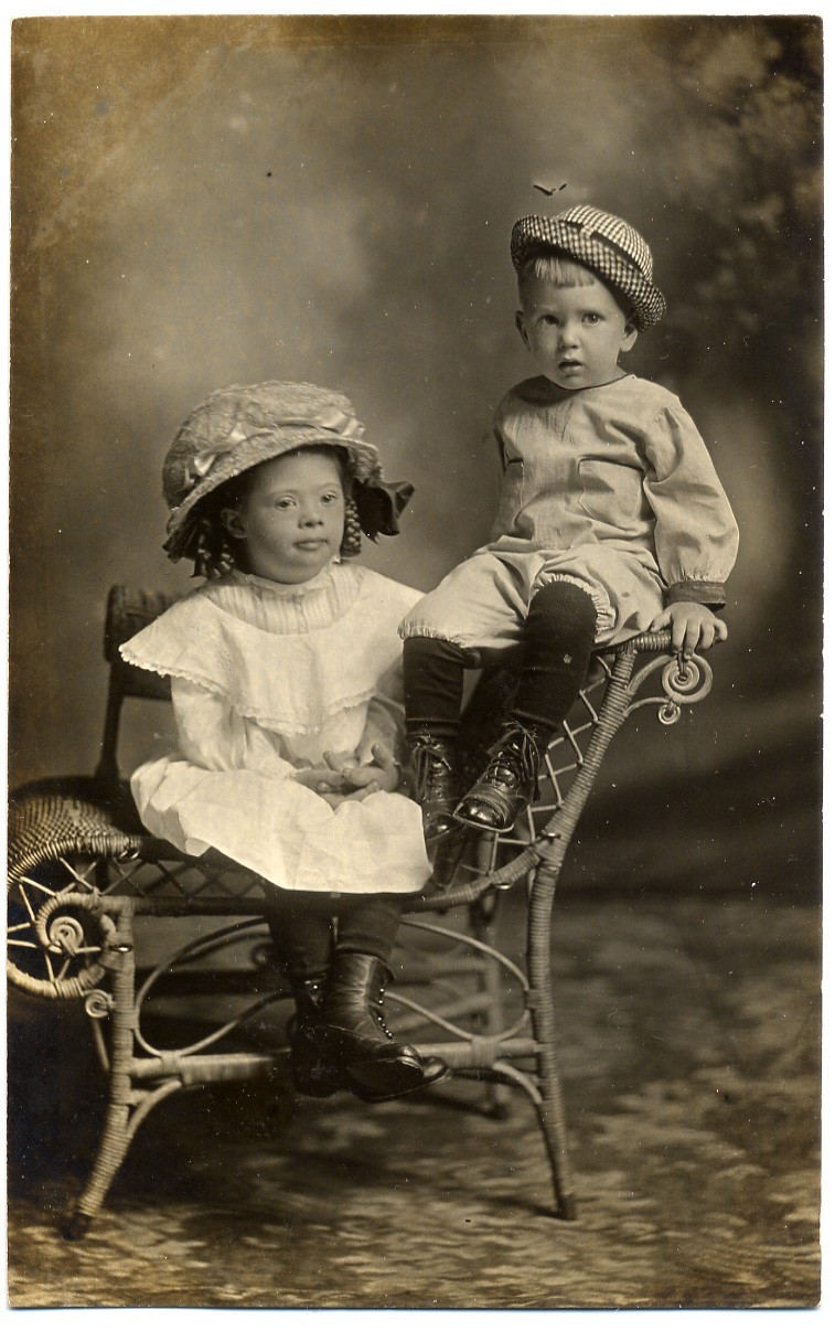 RPPC Down Syndrome Handsome Child, Studio Portrait , Ca.1912 RPPC Down Syndrome Handsome Child, Studio Portrait , Ca.1912