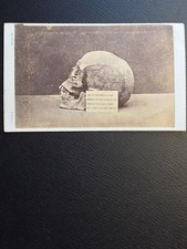 Antique CDV Photo Human Skull King Alfred the Great Hyde Abbey 1879 Victorian picture
