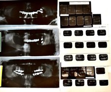 Dental X-Rays Huge Lot Oddities Vintage Teeth Cavities Tooth Jaw 30 + Films picture